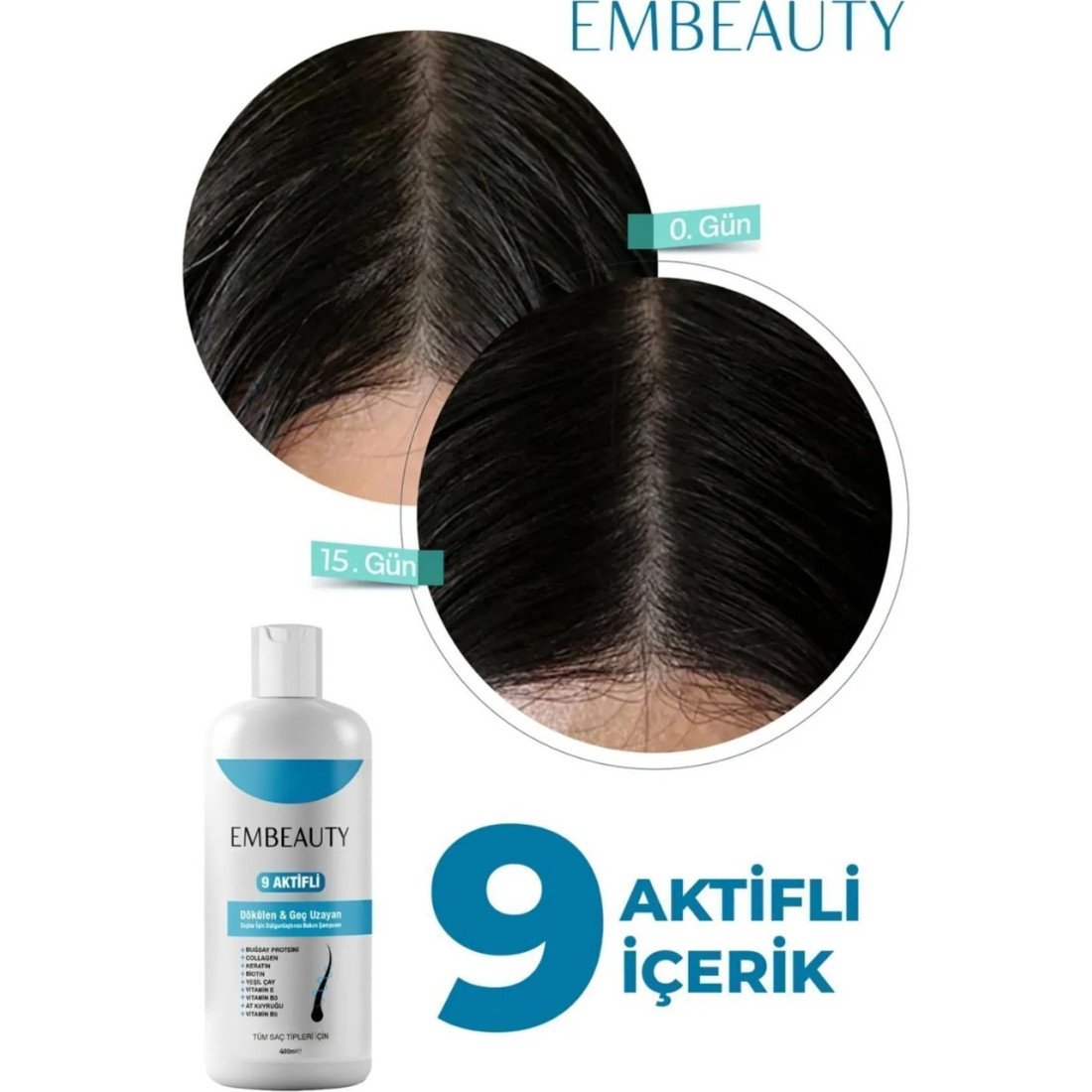 Embeauty Kolajen ve Keratin Saç Dökülmesine Karşı Hızlı Sac Uzatan Dolgunlaştırıcı Onarıcı Besleyici Şampuan